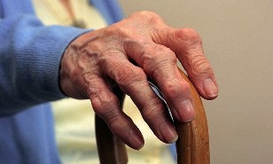 Zapalenie stawów i artroza palców u osoby starszej
