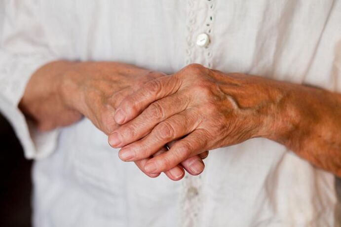 Ból stawów rąk często dokucza osobom starszym