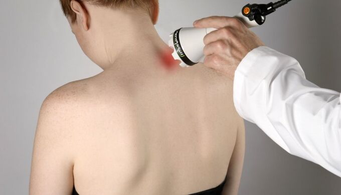 laseroterapia osteochondrozy szyjnej